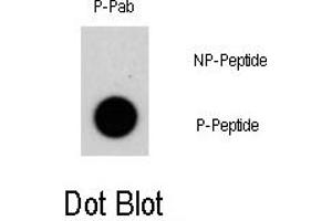 Image no. 1 for anti-Nuclear Receptor Subfamily 4, Group A, Member 1 (NR4A1) (pSer351) antibody (ABIN358306) (NR4A1 anticorps  (pSer351))