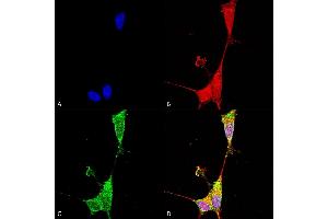 Immunocytochemistry/Immunofluorescence analysis using Mouse Anti-Brevican Monoclonal Antibody, Clone S294A-6 (ABIN2483309).