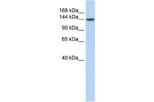 WB Suggested Anti-ATP11B Antibody Titration:  0. (ATP11B anticorps  (N-Term))