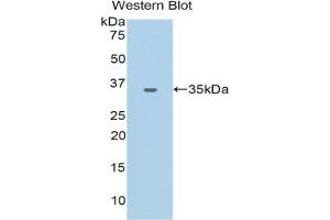 Western blot analysis of the recombinant protein. (CEACAM1 anticorps  (AA 35-320))