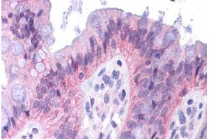 Human Colon: Formalin-Fixed, Paraffin-Embedded (FFPE)