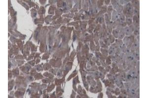 Detection of IL6 in Rat Cardiac Muscle Tissue using Monoclonal Antibody to Interleukin 6 (IL6)