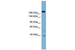 ABCC11 antibody used at 1 ug/ml to detect target protein. (ABCC11 anticorps)