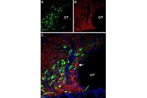 Multiplex staining of AT2 receptor and VGLUT2 in rat supraoptic hypothalamic nucleus - Immunohistochemical staining of perfusion-fixed frozen rat brain sections using Anti-Angiotensin II Receptor Type-2 (extracellular)-ATTO Fluor-488 Antibody (ABIN7042926), (1:60) and Anti-VGLUT2-ATTO Fluor-594 Antibody (ABIN7043682), (1:60).