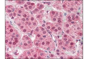 Human Adrenal (formalin-fixed, paraffin-embedded) stained with PARP2at 2. (PARP2 anticorps  (Internal Region))