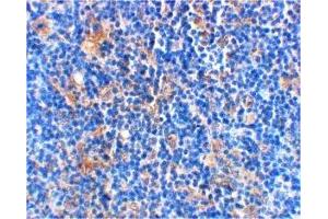 Immunohistochemistry (IHC) image for anti-BCL2-Associated Agonist of Cell Death (BAD) (C-Term) antibody (ABIN1030278) (BAD anticorps  (C-Term))