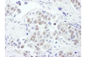 Immunohistochemistry (IHC) image for anti-GATA Binding Protein 3 (GATA3) (AA 150-200) antibody (ABIN7454559)