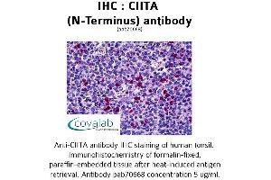 Image no. 1 for anti-Class II, Major Histocompatibility Complex, Transactivator (CIITA) (N-Term) antibody (ABIN1733098)