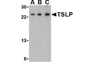 Western Blotting (WB) image for anti-Thymic Stromal Lymphopoietin (TSLP) (Middle Region) antibody (ABIN1031147) (Thymic Stromal Lymphopoietin anticorps  (Middle Region))