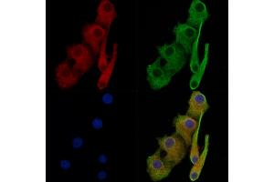 ABIN7093772 and ABIN7097813 staining Hela cells by IF/ICC. (beta Catenin anticorps)
