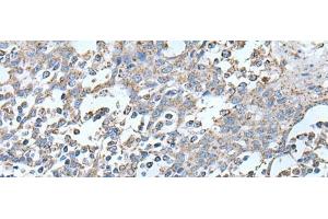 Immunohistochemistry of paraffin-embedded Human tonsil tissue using IRF5 Polyclonal Antibody at dilution of 1:25(x200)