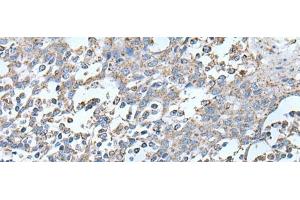 Immunohistochemistry of paraffin-embedded Human tonsil tissue using IRF5 Polyclonal Antibody at dilution of 1:25(x200) (IRF5 anticorps)