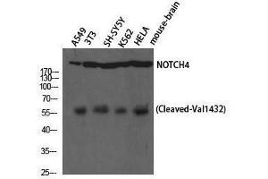 Western Blotting (WB) image for anti-Notch 4 (NOTCH4) (cleaved), (Val1432) antibody (ABIN3181823) (NOTCH4 anticorps  (cleaved, Val1432))