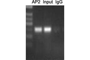 ChIP analysis of Cervical cancer cell lines lysate, incubated for 12 hours at 4°C. (AP2 alpha/beta (C-Term) anticorps)