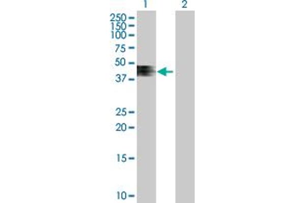 ZNRF4 anticorps  (AA 1-429)