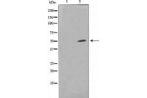 Western blot analysis on HuvEc cell lysate using SUPT3H Antibody,The lane on the left is treated with the antigen-specific peptide. (SUPT3H/SPT3 anticorps  (Internal Region))