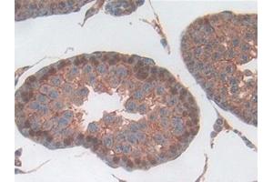 Detection of Hpt in Rat Testis Tissue using Polyclonal Antibody to Haptoglobin (Hpt)