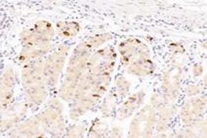 Immunohistochemistry analysis of paraffin-embedded human stomach using,Epsin-3 (ABIN7073856) at dilution of 1: 4400 (EPN3 anticorps)