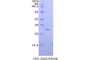 SDS-PAGE of Protein Standard from the Kit (Highly purified E.