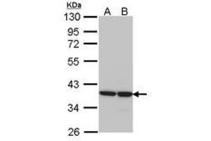 Image no. 1 for anti-Aldo-Keto Reductase Family 1, Member B1 (Aldose Reductase) (AKR1B1) (AA 1-298) antibody (ABIN467605) (AKR1B1 anticorps  (AA 1-298))