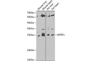 Western blot analysis of extracts of various cell lines, using MTFP1 antibody (ABIN6133078, ABIN6144138, ABIN6144139 and ABIN6222920) at 1:1000 dilution. (Mtfp1 anticorps  (AA 1-166))