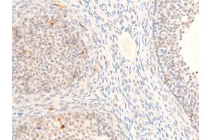 ABIN6267272 at 1/100 staining rat ovarian tissue sections by IHC-P.