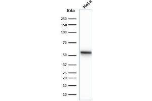 Western Blot Analysis of human HeLa cell lysate using Cytokeratin 7 Mouse Monoclonal Antibody (K72. (Cytokeratin 7 anticorps)