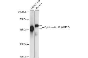 Western blot analysis of extracts of various cell lines, using Cytokeratin 12 (Cytokeratin 12 (KRT12)) antibody (ABIN7268088) at 1:1000 dilution. (KRT12 anticorps  (AA 295-494))