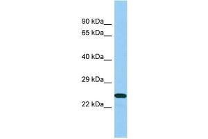 Host: Rabbit Target Name: B9D1 Sample Type: 721_B Whole Cell lysates Antibody Dilution: 1. (B9D1 anticorps  (N-Term))