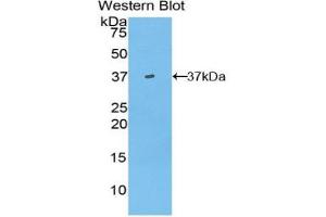 Detection of Recombinant Hepcidin, Porcine using Polyclonal Antibody to Hepcidin (Hepc) (Hepcidin anticorps  (AA 23-82))