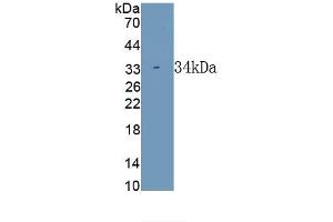 Detection of Recombinant CTGF, Rabbit using Polyclonal Antibody to Connective Tissue Growth Factor (CTGF) (CTGF anticorps  (AA 118-388))