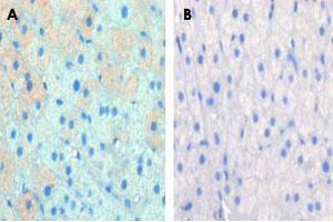 Formalin-fixed and paraffin-embedded cow lactatingreacted with CPT1A polyclonal antibody , which was peroxidase-conjugated to the secondary antibody, followed by AEC staining. (CPT1A anticorps  (C-Term))
