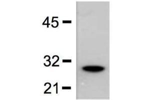 1:5000 (0. (GST anticorps)
