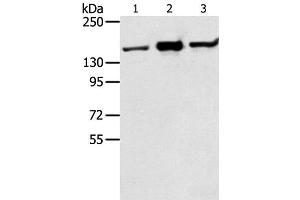 Western Blot analysis of Jurkat, K562 and hela cell using STAG2 Polyclonal Antibody at dilution of 1:350 (STAG2 anticorps)