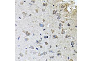 Immunohistochemistry of paraffin-embedded mouse brain using BRCA1 antibody (ABIN5970045) at dilution of 1/100 (40x lens). (BRCA1 anticorps)