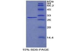 SDS-PAGE analysis of Rat TRADD Protein.