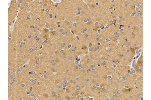 OPRM1 Mouse Monoclonal Antibody at 1/100 staining rat brain tissue by IHC-P. (Mu Opioid Receptor 1 anticorps  (C-Term))