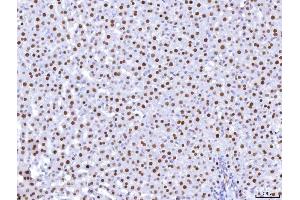 IHC analysis of HNF-4-alpha using anti-HNF-4-alpha antibody (ABIN7600215).