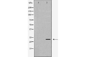 Western blot analysis of extracts of SW480, using LCN2 antibody. (Lipocalin 2 anticorps  (Internal Region))