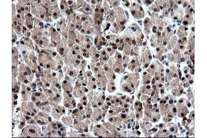 Image no. 1 for anti-RAB37, Member RAS Oncogene Family (RAB37) antibody (ABIN1500561)