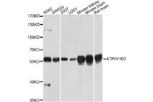 Western blot analysis of extracts of various cell lines, using ATP6V1B2 Antibody (ABIN5971942) at 1/1000 dilution. (ATP6V1B2 anticorps)