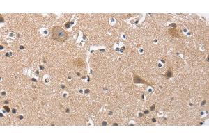 Immunohistochemistry of paraffin-embedded Human brain tissue using BUB1 Polyclonal Antibody at dilution 1:50 (BUB1 anticorps)