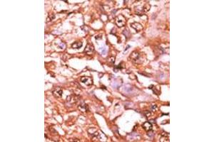 Image no. 2 for anti-Signal Transducer and Activator of Transcription 5A (STAT5A) (pSer726) antibody (ABIN358237) (STAT5A anticorps  (pSer726))