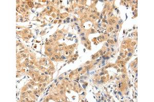 Immunohistochemistry (IHC) image for anti-Tropomyosin-2 (TPM2) antibody (ABIN3017365)