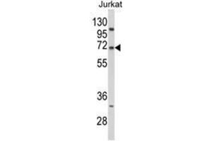 Western blot analysis of PCSK9 Antibody (N-term) in Jurkat cell line lysates (35ug/lane).