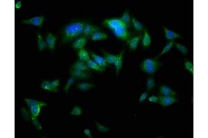 Immunofluorescence staining of HepG2 cells with ABIN7173996 at 1:100, counter-stained with DAPI. (YARS anticorps  (AA 2-528))