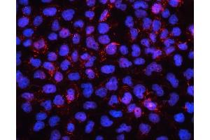 IF analysis of EHD1 using anti-EHD1 antibody (ABIN6719599). (EHD1 anticorps  (AA 324-516))