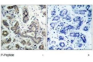 Image no. 1 for anti-BCL2-Associated Agonist of Cell Death (BAD) (pSer136), (pSer99) antibody (ABIN318335) (BAD anticorps  (pSer99, pSer136))