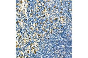 Immunohistochemistry of paraffin embedded mouse spleen using CD42d (ABIN7074111) at dilution of 1:700 (400x lens)