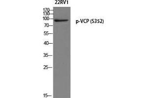 Western Blot (WB) analysis of 22RV1 using p-VCP (S352) antibody. (VCP anticorps  (pSer352))